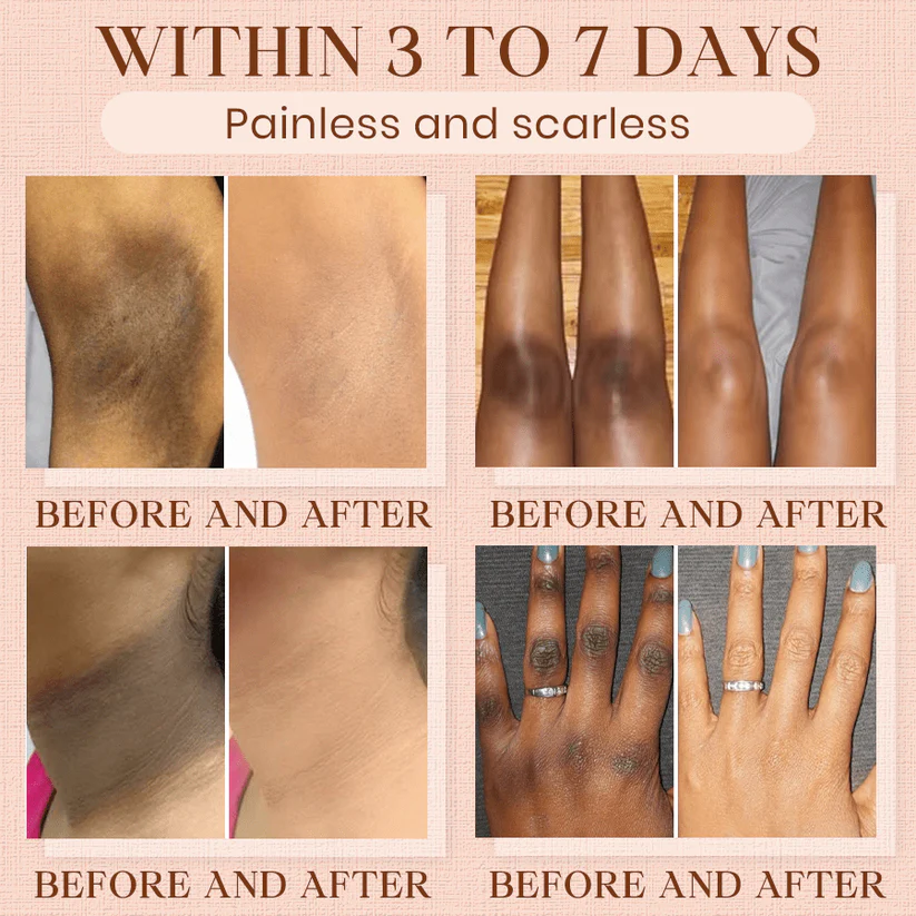 Luhaka® Purifying Exfoliating Gel for Acanthosis Nigricans 8 Luhaka® Purifying Exfoliating Gel for Acanthosis Nigricans