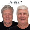 CASELAST™ AdaptableFit Functional Dentures 10 CASELAST™ AdaptableFit Functional Dentures