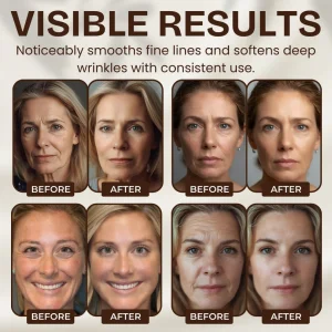 Snail Hydrating Anti-Wrinkle and Rejuvenating Cream 9 Snail Hydrating Anti-Wrinkle and Rejuvenating Cream