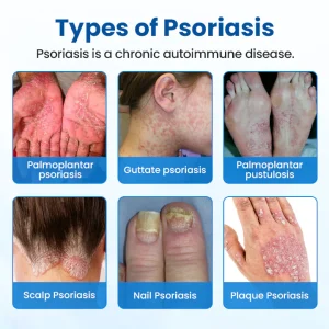 Timilk® Magnesium Herbal Treatment Spray 18 Timilk® Magnesium Herbal Treatment Spray