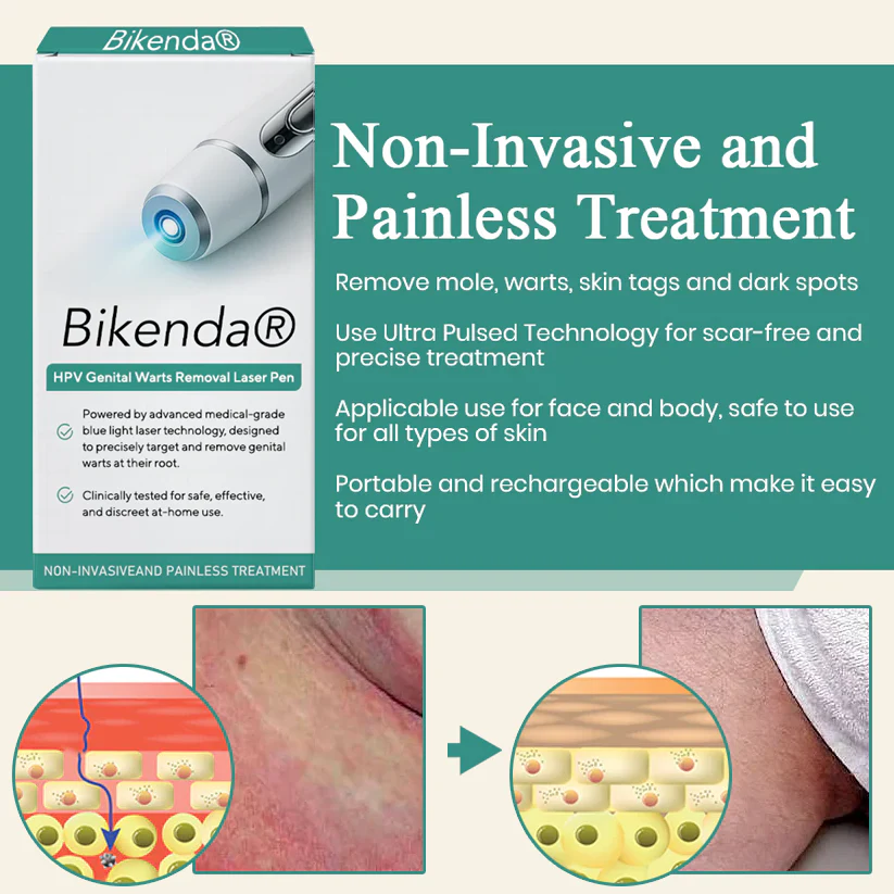 Bikenda® HPV Genital Warts Removal Laser Pen 3 Bikenda® HPV Genital Warts Removal Laser Pen