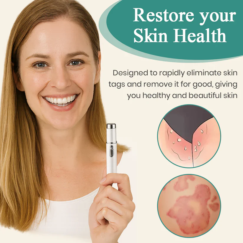 Bikenda® HPV Genital Warts Removal Laser Pen 7 Bikenda® HPV Genital Warts Removal Laser Pen