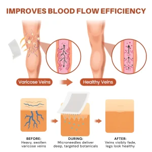 NovaRX® VeinTarget Nanotech Microneedle Patch 9 NovaRX® VeinTarget Nanotech Microneedle Patch