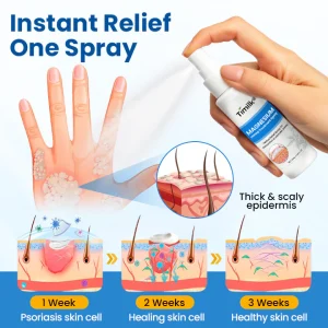 Timilk® Magnesium Herbal Treatment Spray 16 Timilk® Magnesium Herbal Treatment Spray