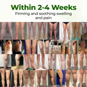 NovaRX® FluidEase Leg Therapy Edema Cream 8 NovaRX® FluidEase Leg Therapy Edema Cream