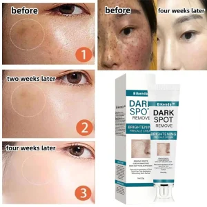 Bikenda™ Blemish Removing Beauty Cream