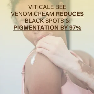 Oveallgo® VitiClear Bee Venom Cream Ultra 10 Oveallgo® VitiClear Bee Venom Cream Ultra