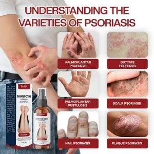 Timilk® DermSoothe Psoriasis Relief Spray 13 Timilk® DermSoothe Psoriasis Relief Spray