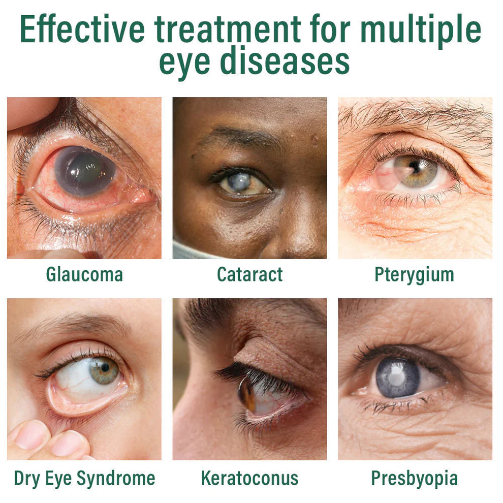 LOVILDS™ Nano Eye Drops Serum 2 LOVILDS™ Nano Eye Drops Serum