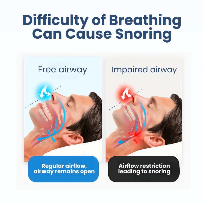 Lyyeto® Snoreless Nasal Breather 4 Lyyeto® Snoreless Nasal Breather