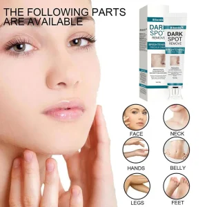 Bikenda™ Blemish Removing Beauty Cream