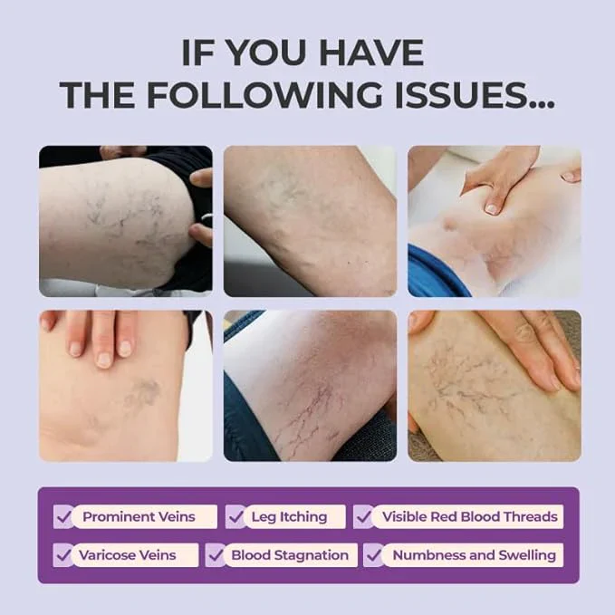 AQA™ Leg Relief Varicose Veins Cream 3 AQA™ Leg Relief Varicose Veins Cream