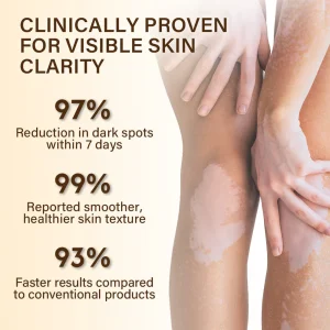 Oveallgo® VitiClear Bee Venom Cream Ultra 11 Oveallgo® VitiClear Bee Venom Cream Ultra