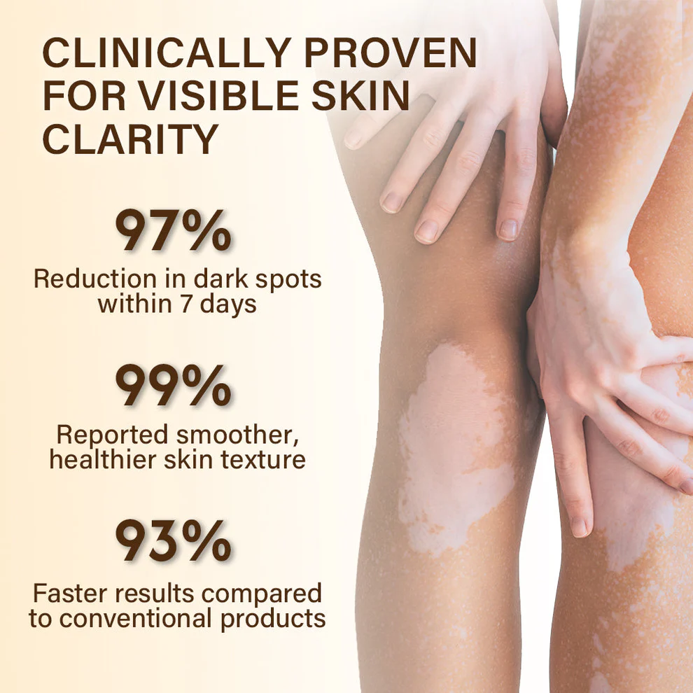 Oveallgo® VitiClear Bee Venom Cream Ultra 4 Oveallgo® VitiClear Bee Venom Cream Ultra