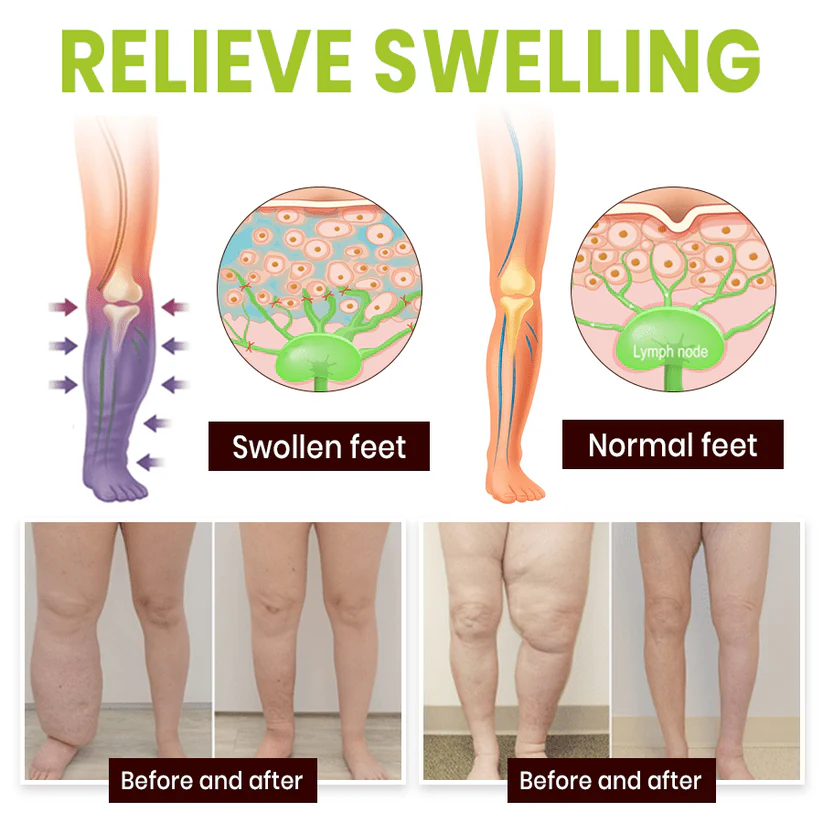 Lyyeto® Professional Leg Circulation Cream 4 Lyyeto® Professional Leg Circulation Cream