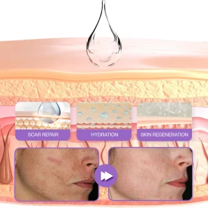 Timilk® RevivaDerma Face & Body Scar Gel - Clinically proven