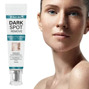 Bikenda™ Blemish Removing Beauty Cream