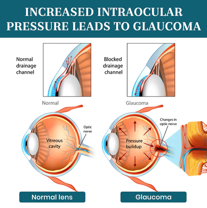 Lyyeto® OptiFusion Nano Eye Drops Serum 6 Lyyeto® OptiFusion Nano Eye Drops Serum