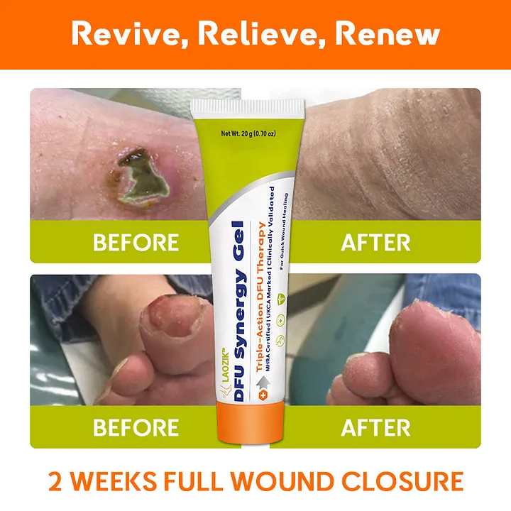 LAOZIK™ DFU Synergy Gel 10 LAOZIK™ DFU Synergy Gel