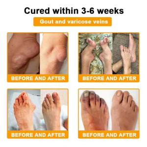 Yagoo™ Botulinum & Bee Essence Pain Relief Bone Healing Cream 28 Yagoo™ Botulinum & Bee Essence Pain Relief Bone Healing Cream