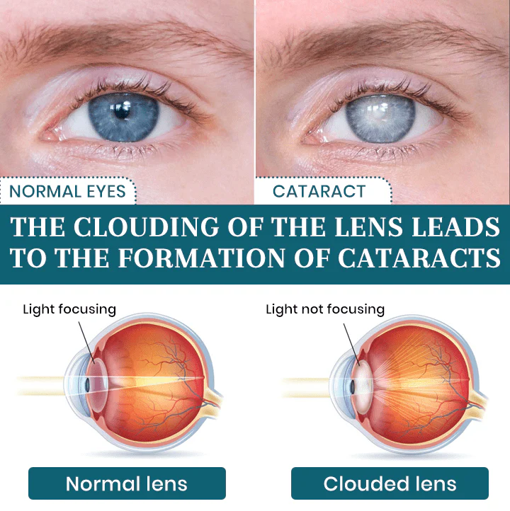 Lyyeto® OptiFusion Nano Eye Drops Serum 5 Lyyeto® OptiFusion Nano Eye Drops Serum