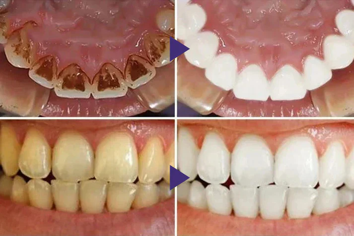 LOVILDS™ Gum Care Gel – Restore & Strengthen Your Gums 5 LOVILDS™ Gum Care Gel – Restore & Strengthen Your Gums