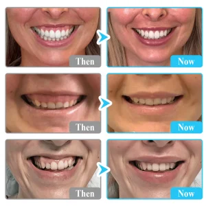 Lyyeto® Focussmile bee venom treatment powder for oral use 10 Lyyeto® Focussmile bee venom treatment powder for oral use