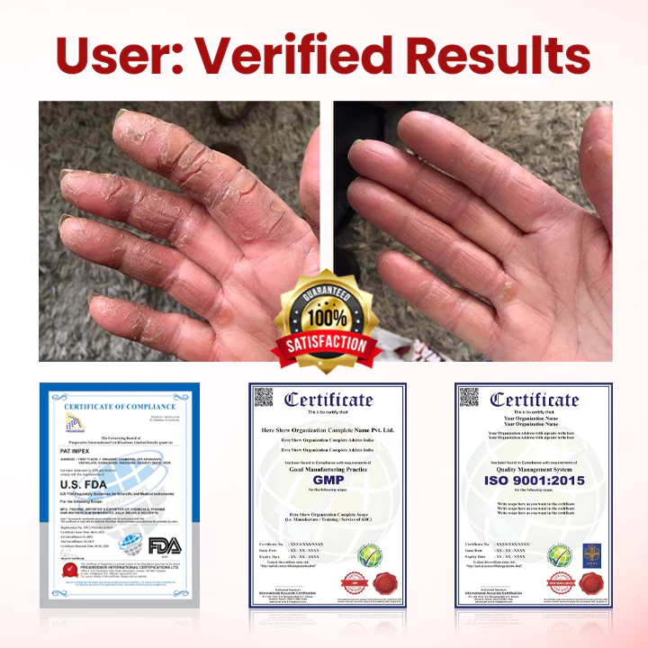 Yagoo® VitaGluco Diabetic Care Cream 3 Yagoo® VitaGluco Diabetic Care Cream