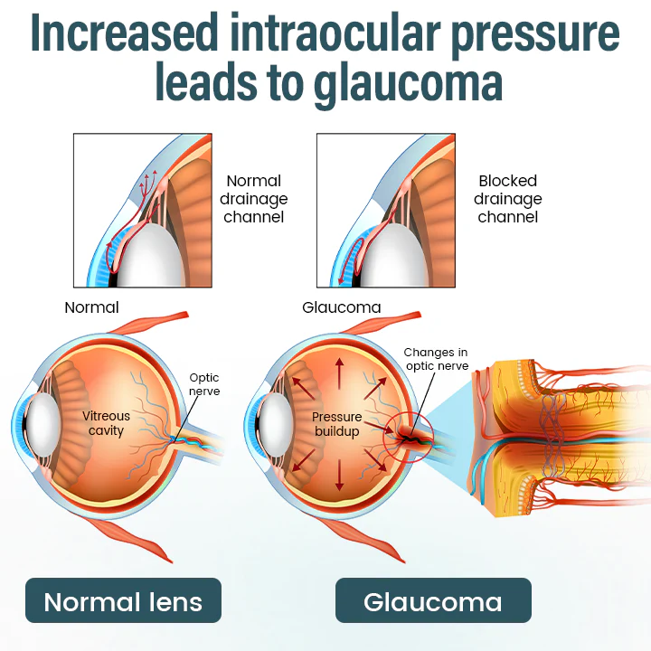 Piguiay® OptiFusion Nano Eye Drops Serum 6 Piguiay® OptiFusion Nano Eye Drops Serum