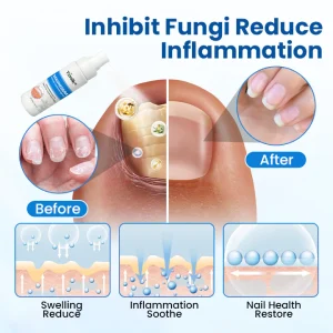 Timilk® Magnesium Herbal Treatment Spray 21 Timilk® Magnesium Herbal Treatment Spray