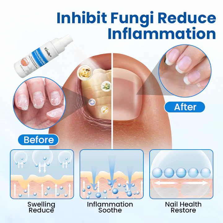 Timilk® Magnesium Herbal Treatment Spray 9 Timilk® Magnesium Herbal Treatment Spray