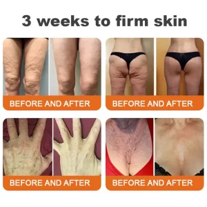 ODALIT® Bee Venom Skin Restoration Cream