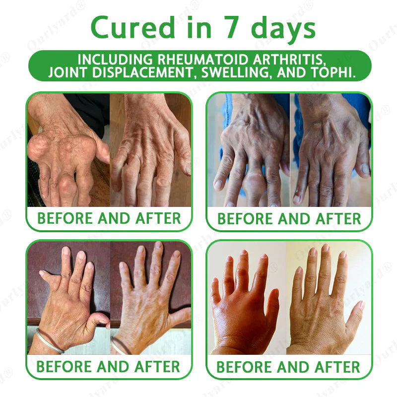 Ourlyard® Advanced Magnesium & Emu Oil Massage Pain Relief Cream 6 Ourlyard® Advanced Magnesium & Emu Oil Massage Pain Relief Cream