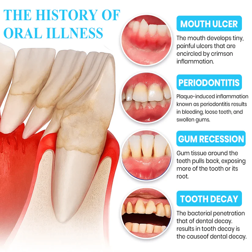 Lyyeto® Focussmile bee venom treatment powder for oral use 7 Lyyeto® Focussmile bee venom treatment powder for oral use