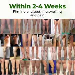 BBOJI® Professional Leg Circulation Cream 7 BBOJI® Professional Leg Circulation Cream