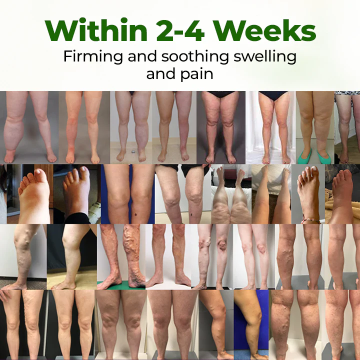 BBOJI® Professional Leg Circulation Cream 2 BBOJI® Professional Leg Circulation Cream