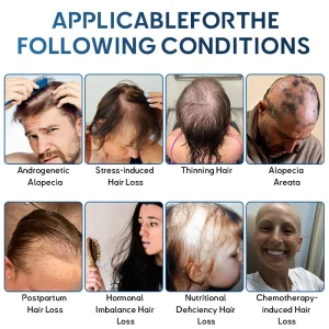 Rolimey® Stem Cell Hair Cycle Roller 18 Rolimey® Stem Cell Hair Cycle Roller