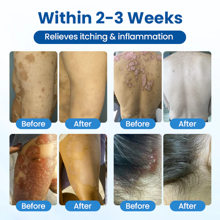 Timilk® Magnesium Herbal Treatment Spray 2 Timilk® Magnesium Herbal Treatment Spray