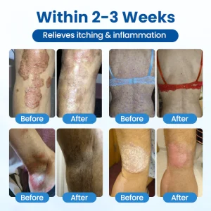 Timilk® Magnesium Herbal Treatment Spray 15 Timilk® Magnesium Herbal Treatment Spray