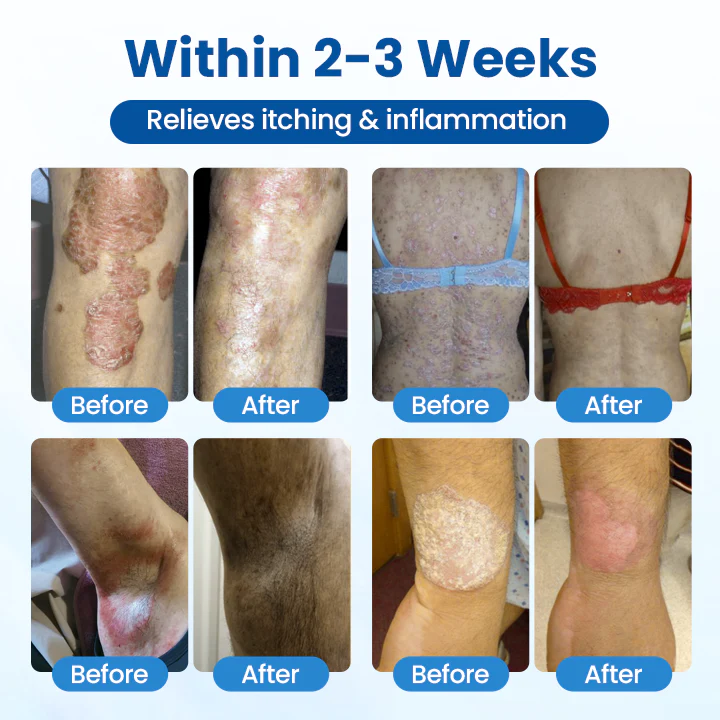 Timilk® Magnesium Herbal Treatment Spray 3 Timilk® Magnesium Herbal Treatment Spray