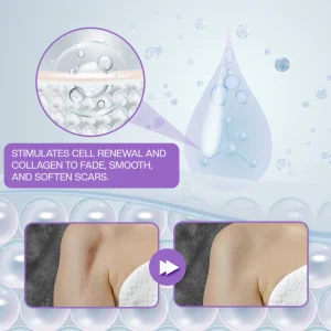 Timilk® RevivaDerma Face & Body Scar Gel - Clinically proven