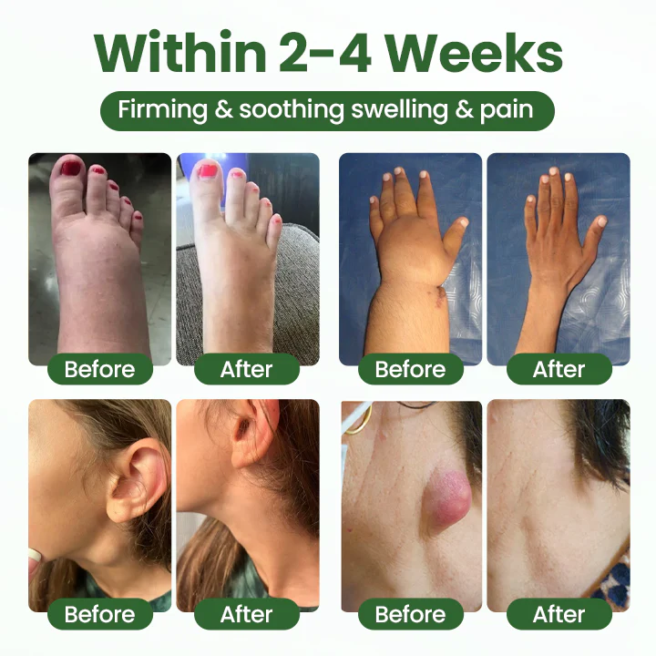 Timilk® BodyRelief Circulation Cream 2 Timilk® BodyRelief Circulation Cream