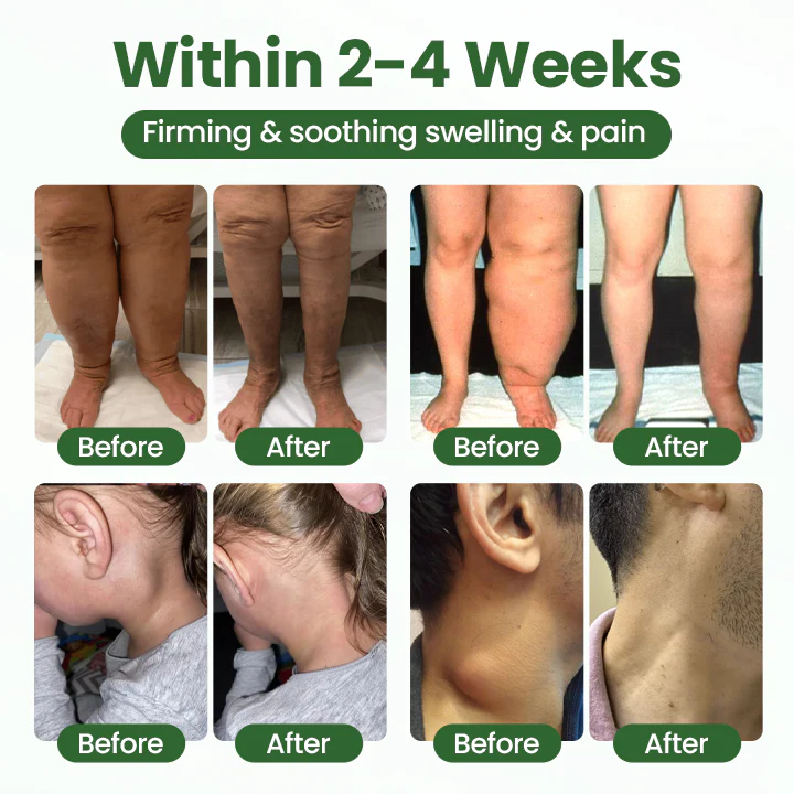 Timilk® BodyRelief Circulation Cream 3 Timilk® BodyRelief Circulation Cream