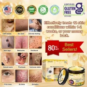 Laozik™ Skin Restoration Cream 16 Laozik™ Skin Restoration Cream - Image 16