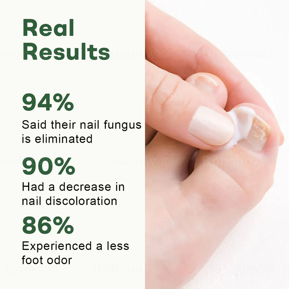 Dobshow® Nail Fungus Renewal Gel 4 Dobshow® Nail Fungus Renewal Gel