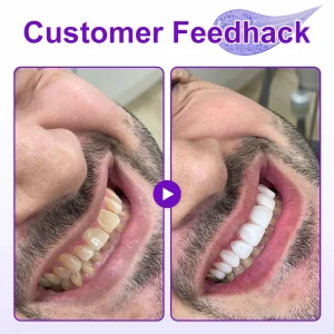 Zvoevo® New 7-Pro Intensive Toothpaste 19 Zvoevo® New 7-Pro Intensive Toothpaste