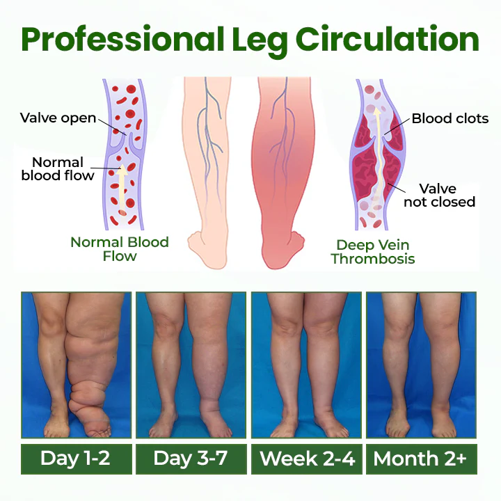 Timilk® BodyRelief Circulation Cream 6 Timilk® BodyRelief Circulation Cream