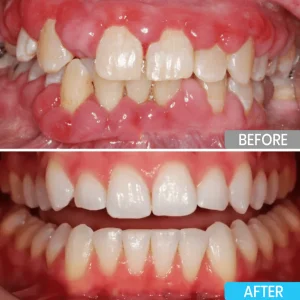 Lyyeto® Focussmile bee venom treatment powder for oral use 8 Lyyeto® Focussmile bee venom treatment powder for oral use