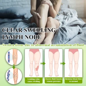 ATTDX® Fluid Regulation Edema Care Cream 15 ATTDX® Fluid Regulation Edema Care Cream