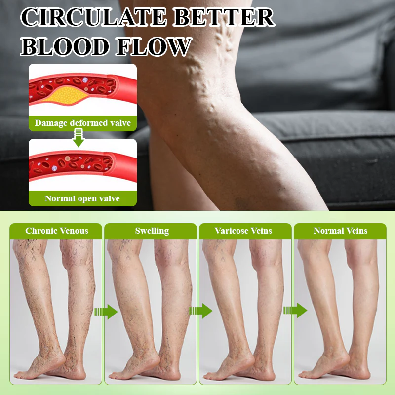 ATTDX® Fluid Regulation Edema Care Cream 5 ATTDX® Fluid Regulation Edema Care Cream